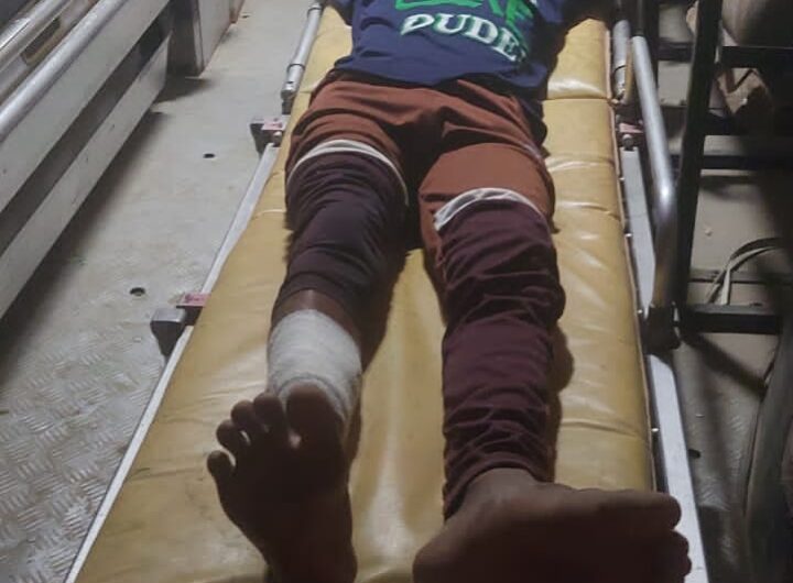 बलरामपुर: 25 हजार का इनामी बदमाश पुलिस मुठभेड़ में गिरफ्तार