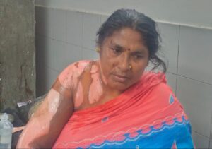 टंकी-ब्लास्ट-से-दर्जनों-हुए-घायल